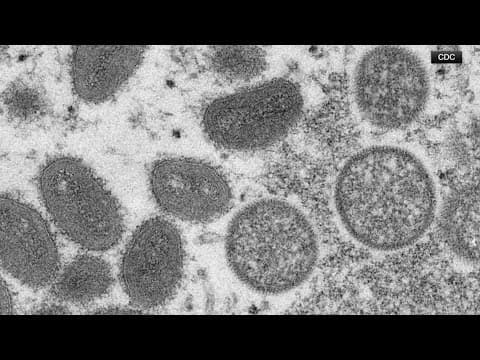 CDC warns Mpox surges may cause global threat