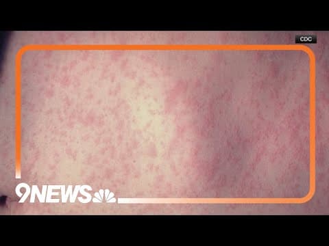 Colorado health authorities confirm 2nd measles case in infant