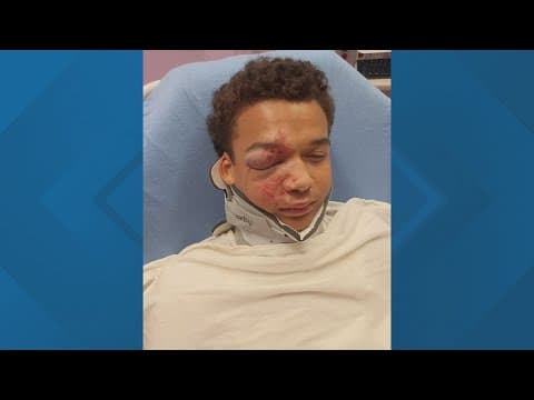 Guard charged after reported attack at Dallas County Juvenile Justice Center