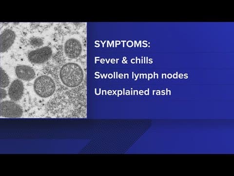 12 mpox cases reported in Virginia
