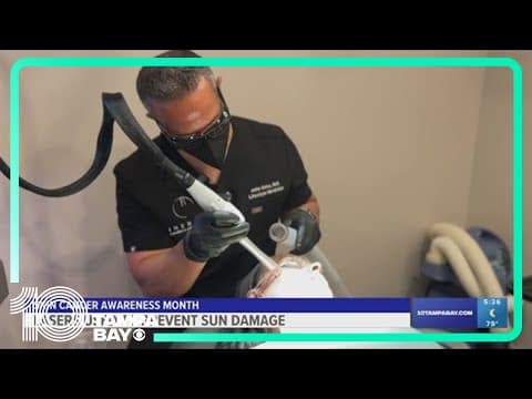 How lasers could help treat sun damage, prevent future risk