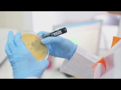 Houston news: 7 human cases of West Nile virus reported in Harris County