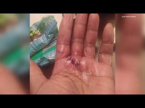 Road rage turns into attack with an ax