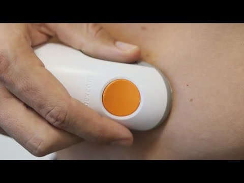 Local kids with type 1 diabetes head to Padres game, made possible by local tech company