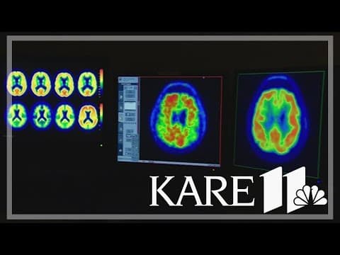 Native Americans more likely to develop dementia, per report