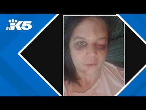 Renton transgender woman attacked near transit center; 2 teens arrested