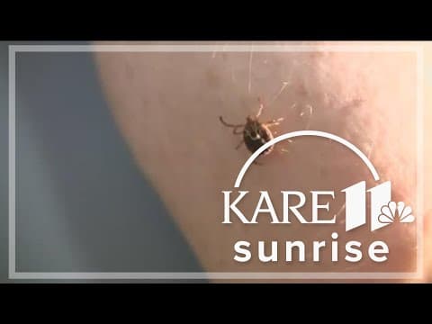Lyme Disease cases growing due in part to a warm start to the season