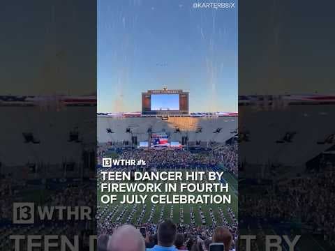 Teen dancer hit by firework in Fourth of July celebration