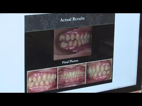 Orthodontists warn against using DIY solutions to 'fix' your smile