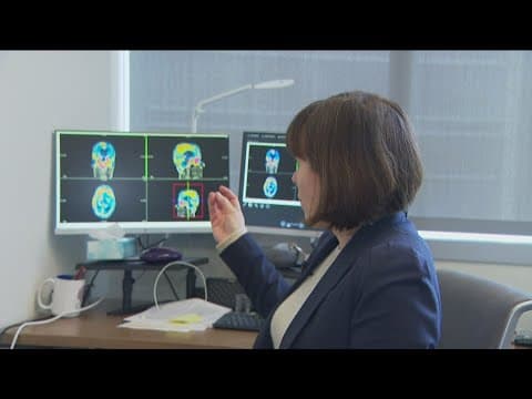 Why is Alzheimer’s worse in women than men? UC San Diego is looking for the answer