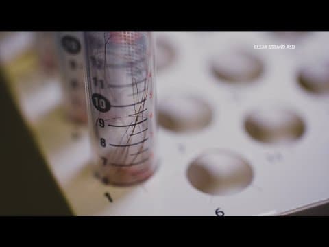 A new hair test brings clarity to autism detection for toddlers