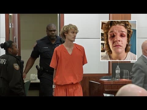 Teen may lose sight after being splashed in the face with chemical powder, Friendswood police say