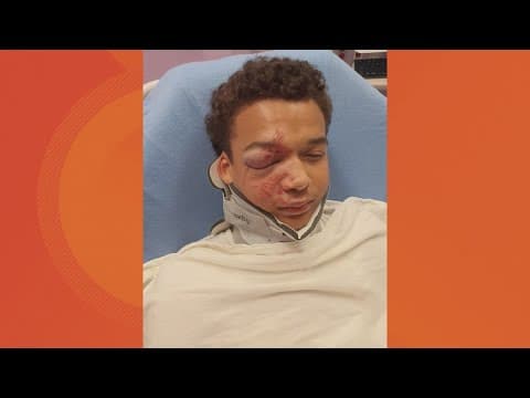 Family seeks justice after a teen was badly beaten at a juvenile justice facility