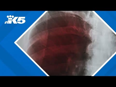 Pierce County woman who refused treatment for her tuberculosis now fully cured