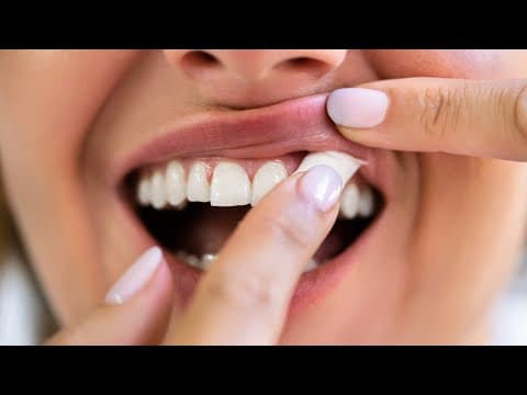 Zyn | What to know about the popular nicotine pouches