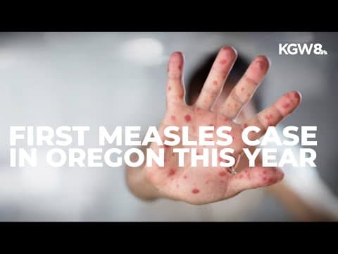 Oregon reports first measles case of 2025 in Multnomah County; public exposure possible