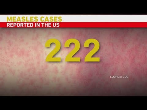 Measles cases in 12 states, mostly in Texas and New Mexico