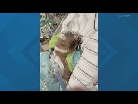 Indy 3-year-old survives surgery to remove part of her skull after abuse from father