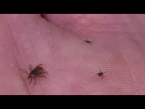What to know about Lyme disease as summer approaches