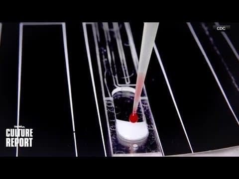 Medical expert discusses impact of funding cuts to HIV research grants