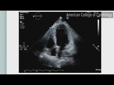 Hospitals see spike in 'broken heart' syndome cases