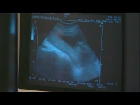 Temporarily block on Ohio's heartbeat law extended