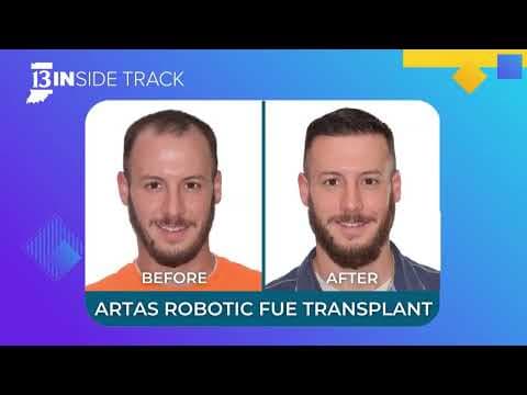 Barry Krauss shares his We Grow Hair Indy experience