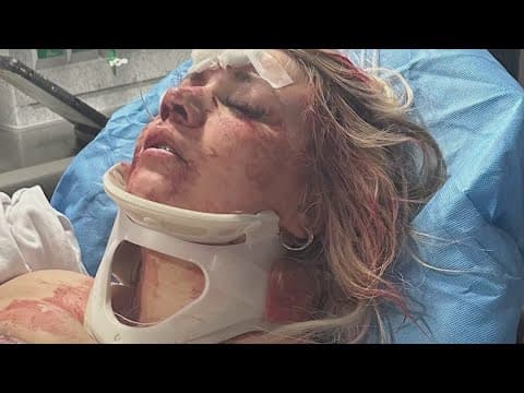 Man arrested after attacking bridal party in Dallas