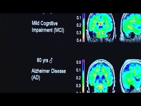 New study links dementia to air pollution