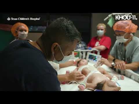 Parents hold conjoined twin boys before surgery at TCH in Houston