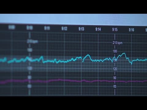 New tech gives moms extra safety during labor