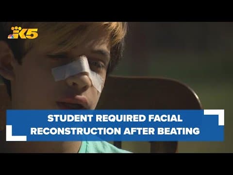 Frontier Middle School student beaten by classmate required facial reconstruction surgery