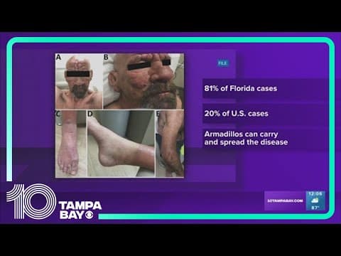 Leprosy could become common, reoccurring illness in Florida