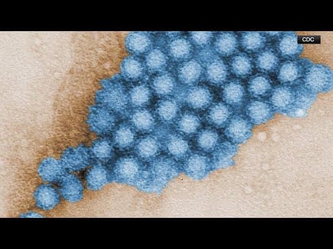 CDC: Norovirus cases are on the rise