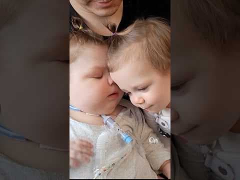 Family searches for nurse for formerly conjoined twin