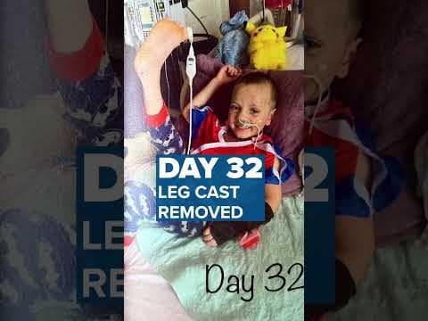 Boy thrown from #MallOfAmerica balcony makes miraculous recovery #shorts #kare11 #minnesota