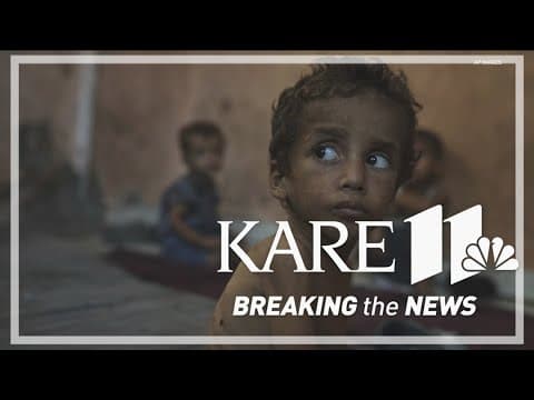 Commentary: The starving children in Gaza