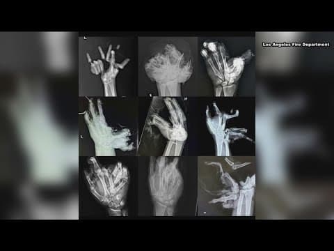 Fourth of July safety | Fireworks and runaway pets