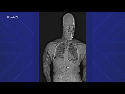 Orlando police: Houston man swallowed stolen jewelry