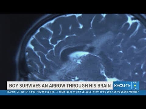 Against all odds: Boy survives arrow through brain in rare medical miracle