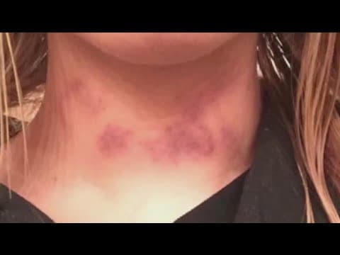 Rape survivor reacts to news no criminal charges will be filed in alleged SDSU gang rape