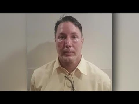 Fugitive in Tijuana murder had plastic surgery, facial implants