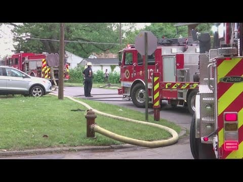 Fire at North Linden apartment leaves 1 seriously injured