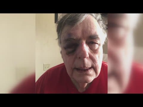 Substitute teacher wants police to take action after he was attacked by student