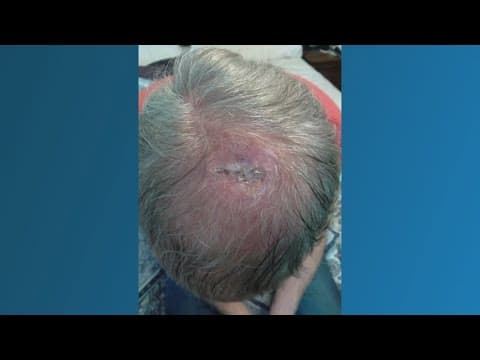 How can you protect your skin while having fun in the sun?