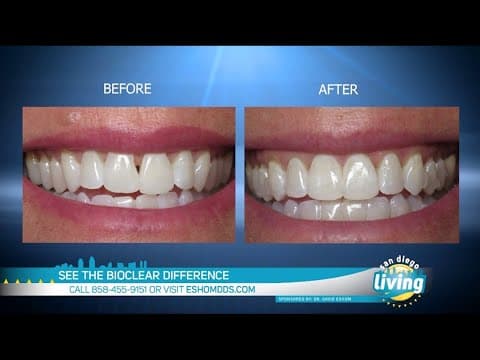Self-Conscious About Your Teeth? | Transform Your Smile with Cutting Edge Alternative to Porcelain V